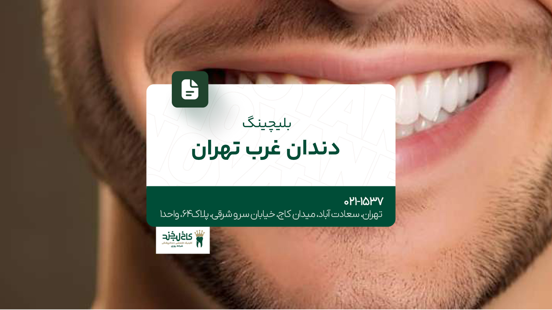 بلیچینگ دندان غرب تهران بلیچینگ دندان غرب تهران