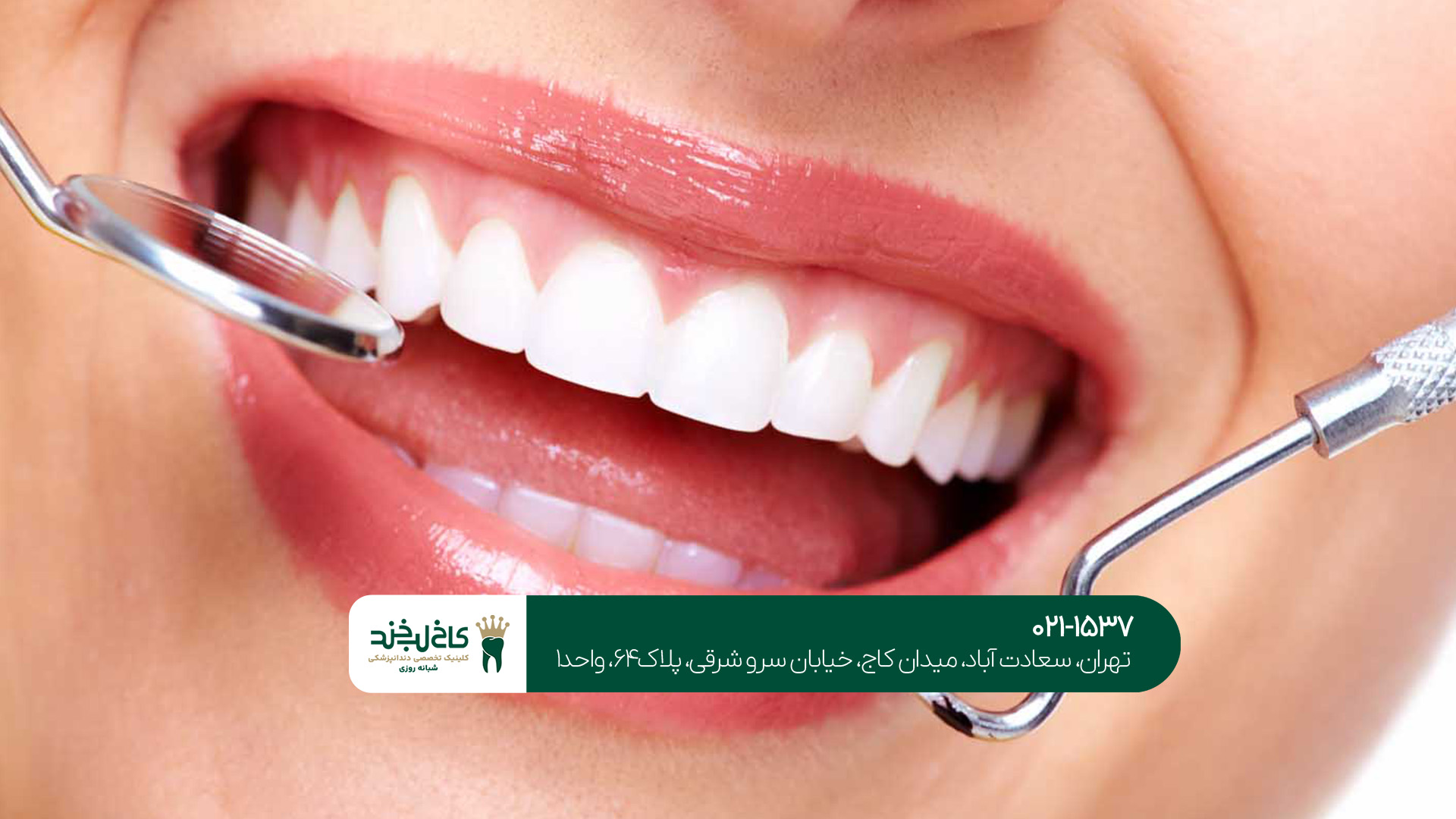 انواع روشهای درمان زیبایی دندان انواع روشهای درمان زیبایی دندان