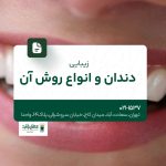 زیبایی دندان و انواع روش آن