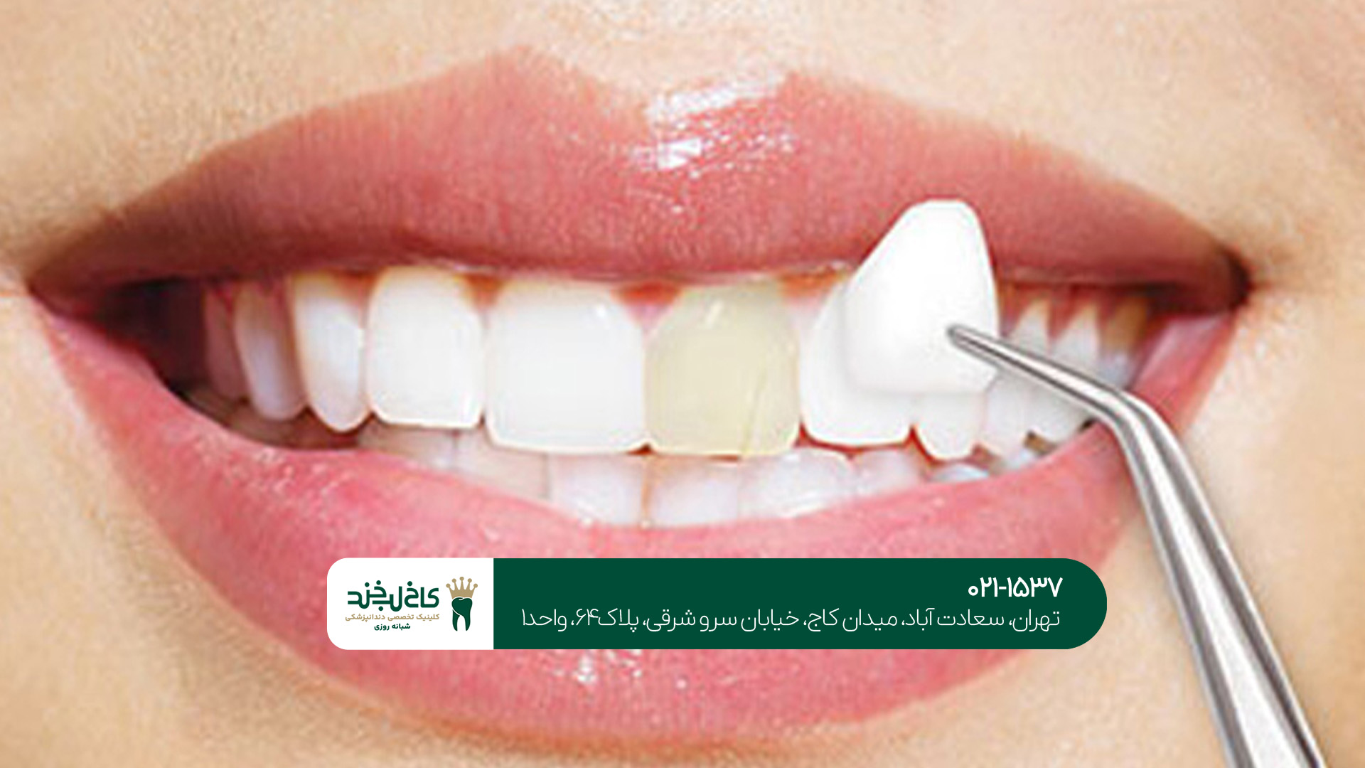 کلینیک تخصصی زیبایی دندان کلینیک تخصصی زیبایی دندان