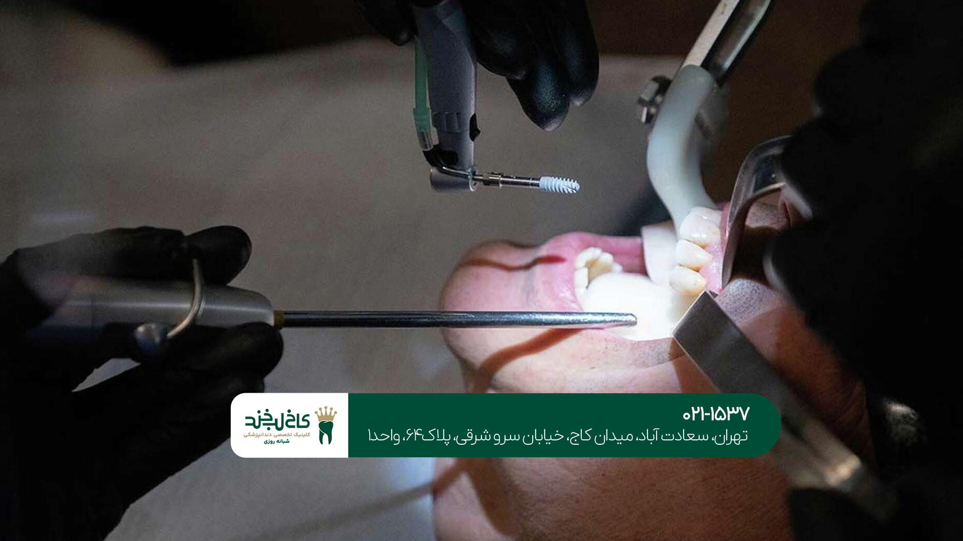 بهترین دندانپزشک در بلوار فردوس