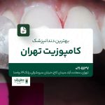 بهترین دندانپزشک کامپوزیت تهران