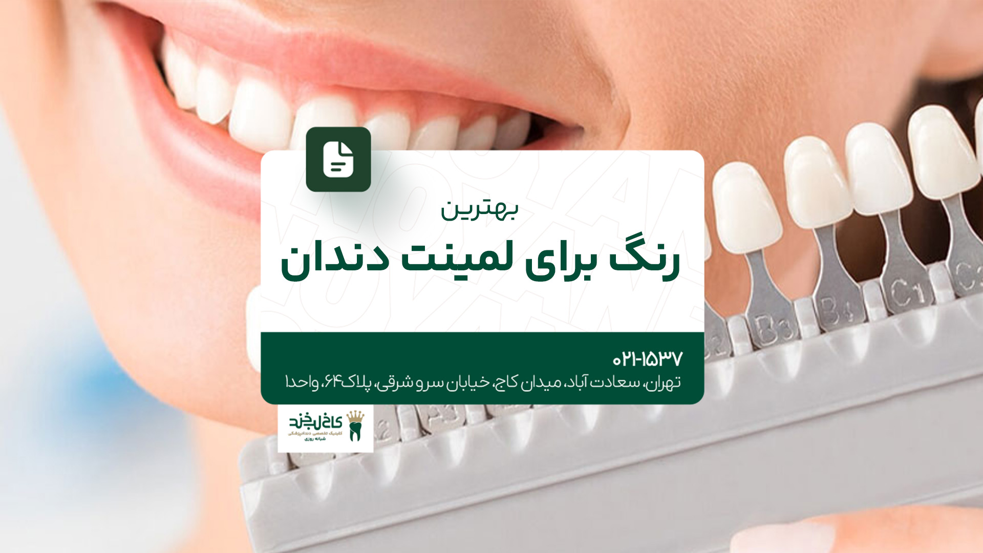 بهترین رنگ برای لمینت دندان