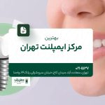 بهترین مرکز ایمپلنت تهران