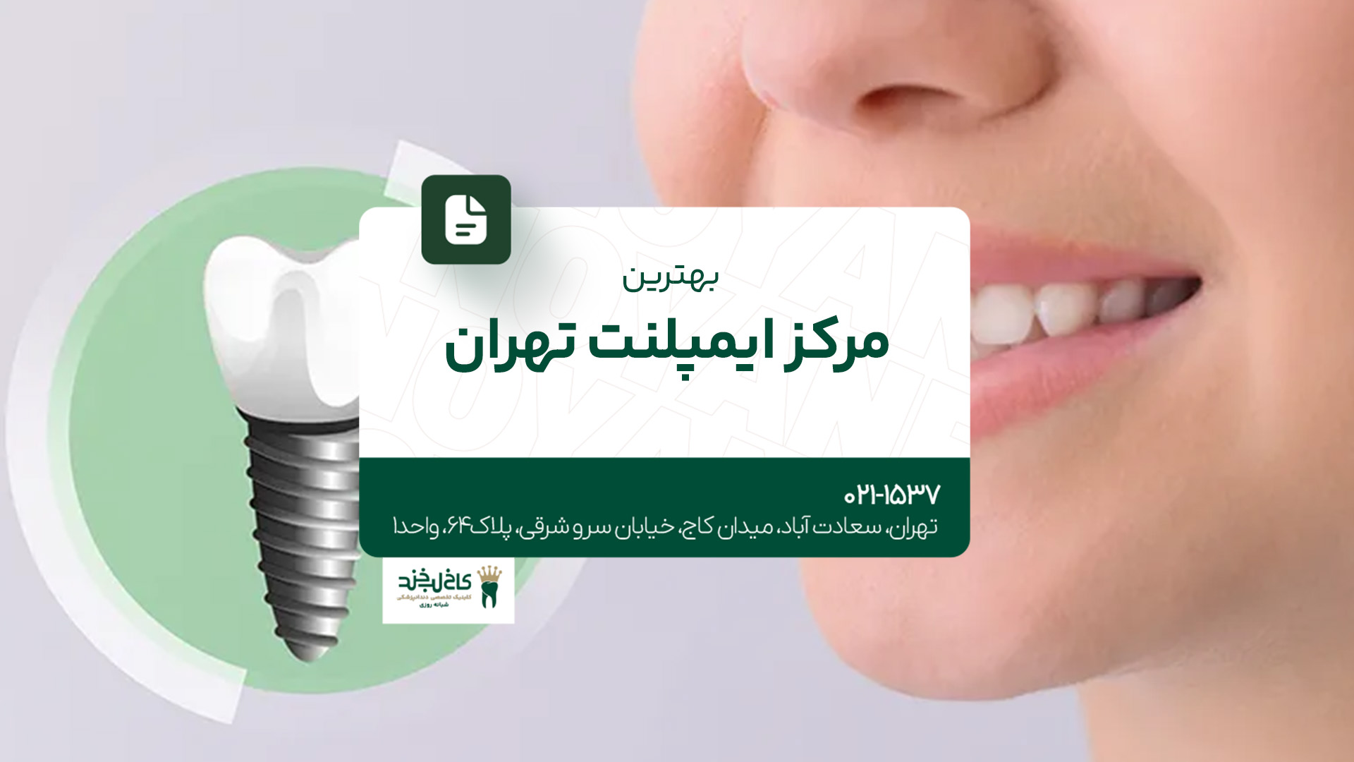 بهترین مرکز ایمپلنت تهران بهترین مرکز ایمپلنت تهران
