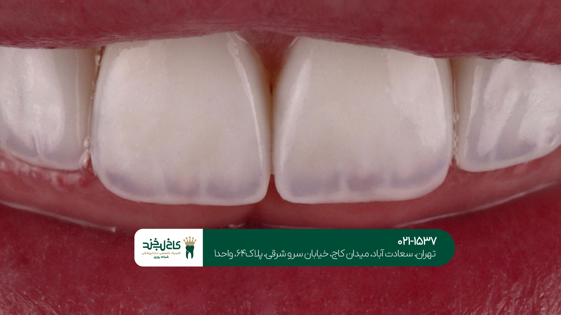 بهترین مرکز کامپوزیت بهترین مرکز کامپوزیت