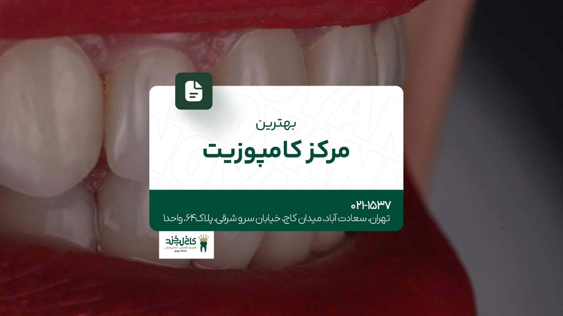 بهترین مرکز کامپوزیت بهترین مرکز کامپوزیت