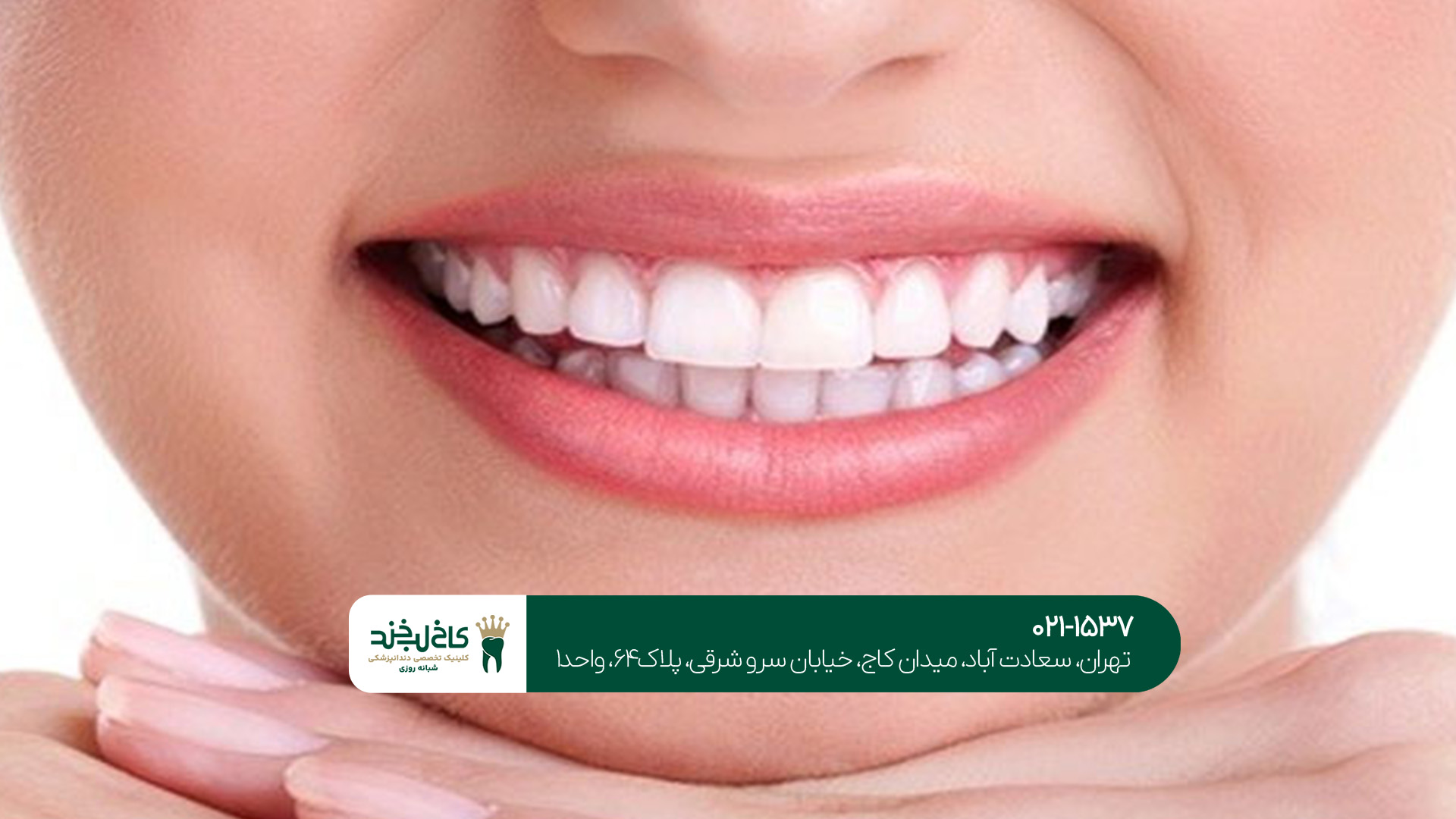 زیبایی دندان و انواع روش آن زیبایی دندان و انواع روشهای آن