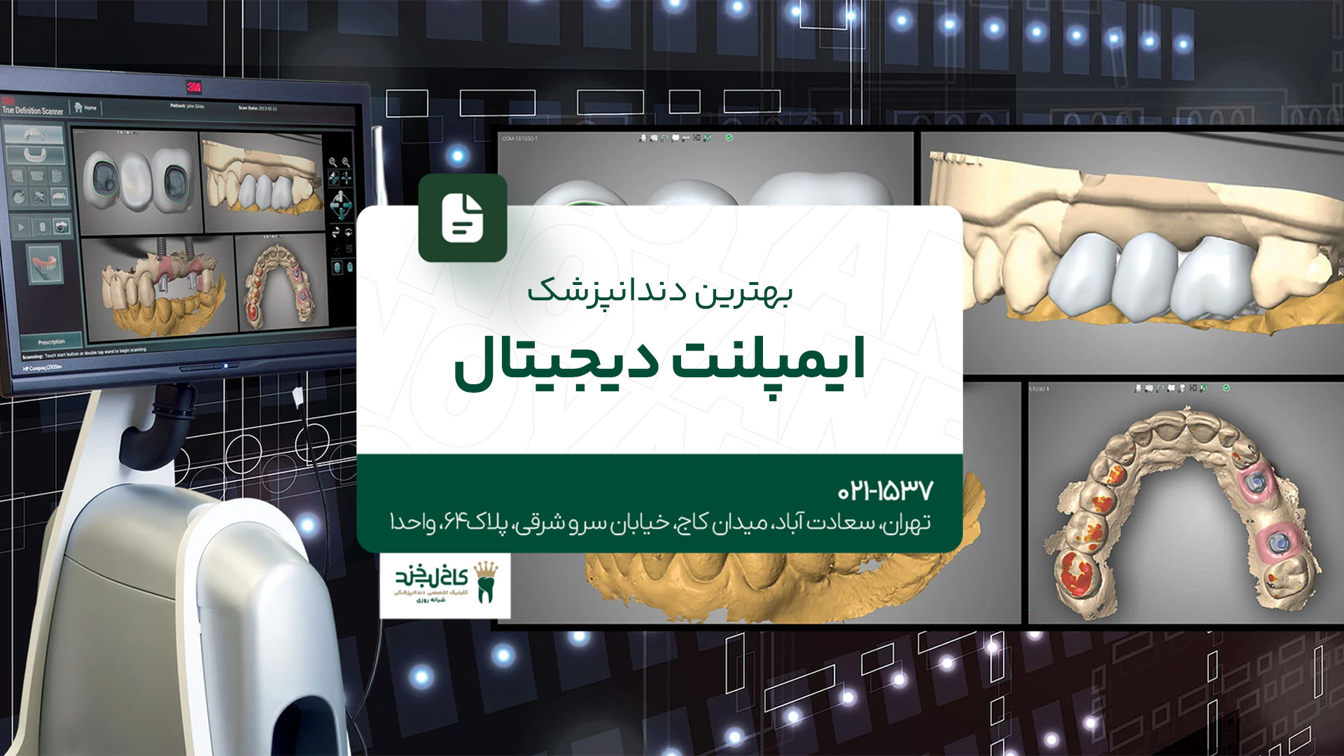بهترین دندانپزشک ایمپلنت دیجیتال بهترین دندانپزشک ایمپلنت دیجیتال