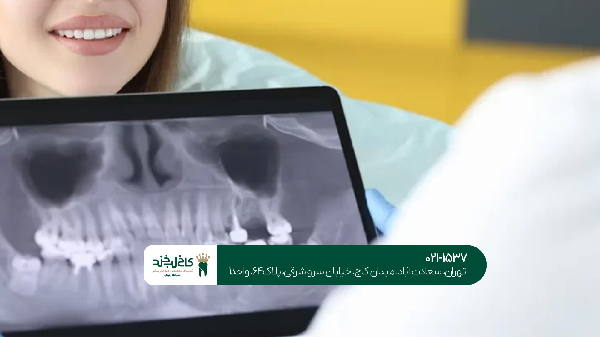 بهترین دندانپزشک ایمپلنت دیجیتال بهترین دندانپزشک ایمپلنت دیجیتال