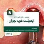 بهترین دندانپزشک ایمپلنت غرب تهران