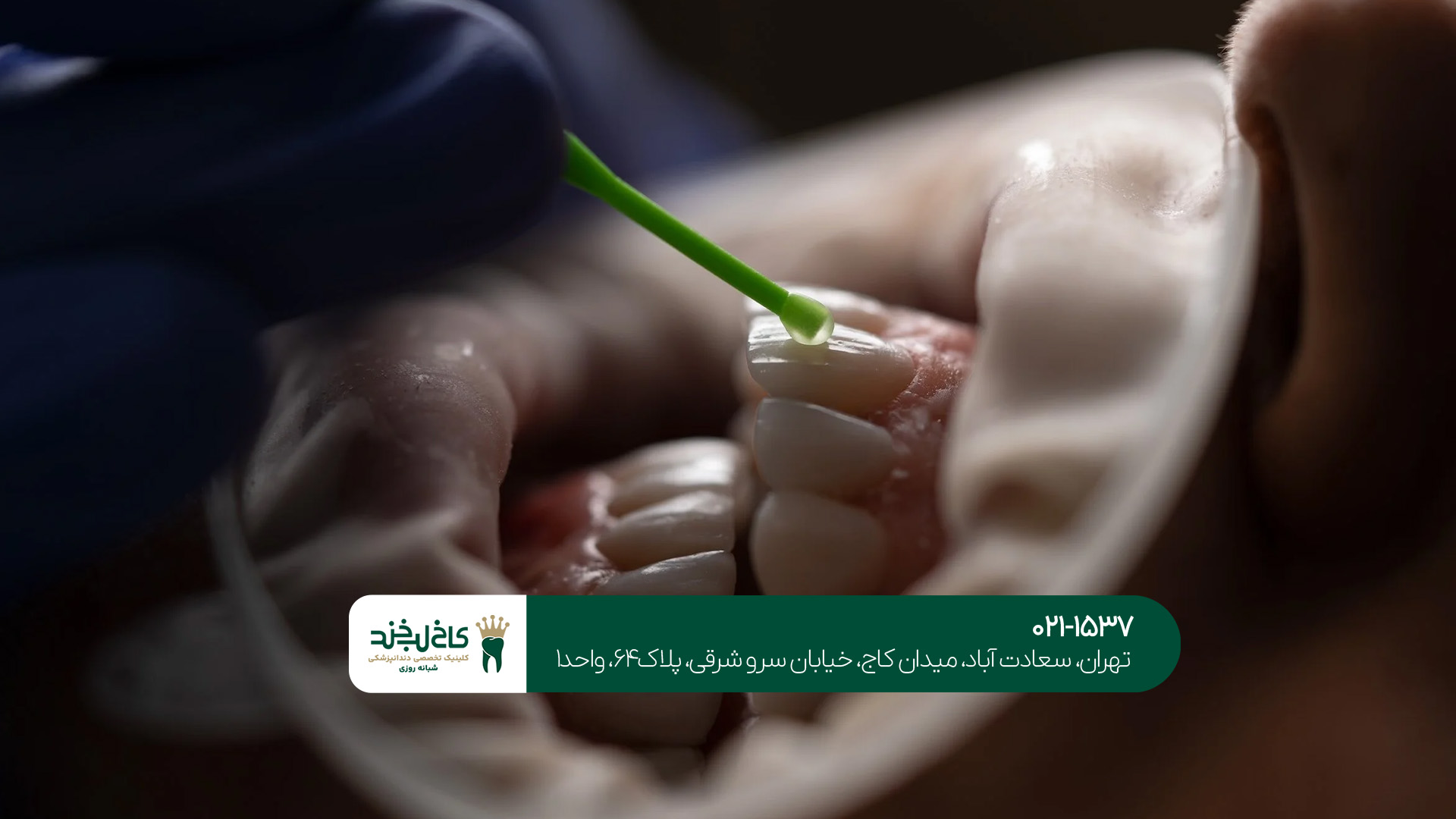 بهترین دندانپزشک در بلوار فردوس