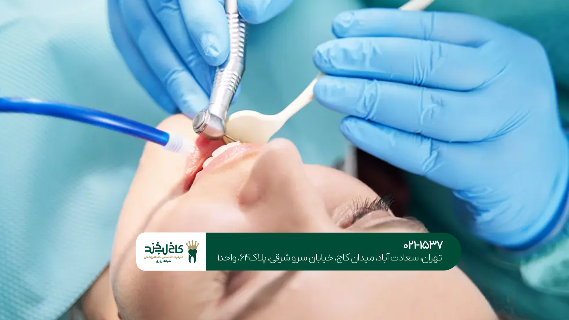 بهترین دندانپزشک زیبایی در تهران