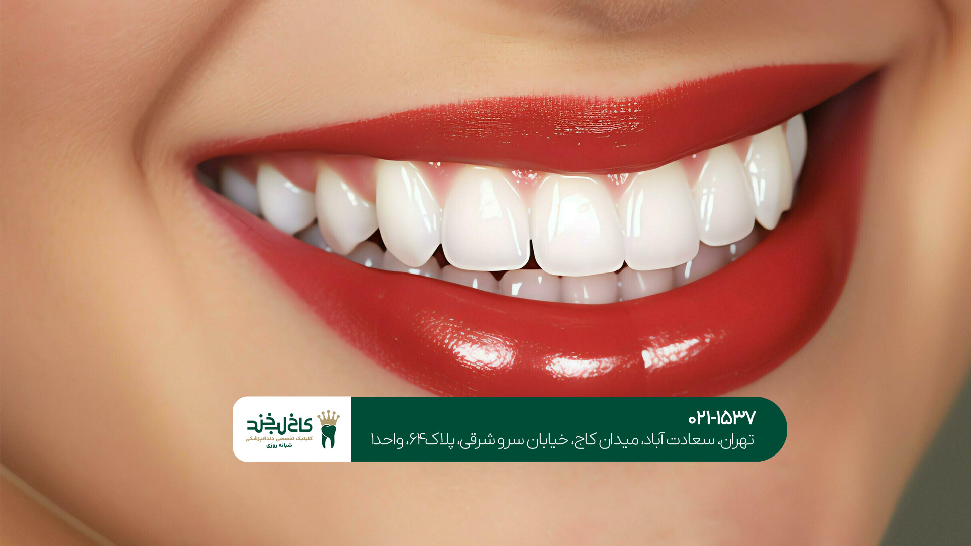 بهترین دندانپزشک زیبایی و تخصصی تهران بهترین دندانپزشک زیبایی و تخصصی تهران