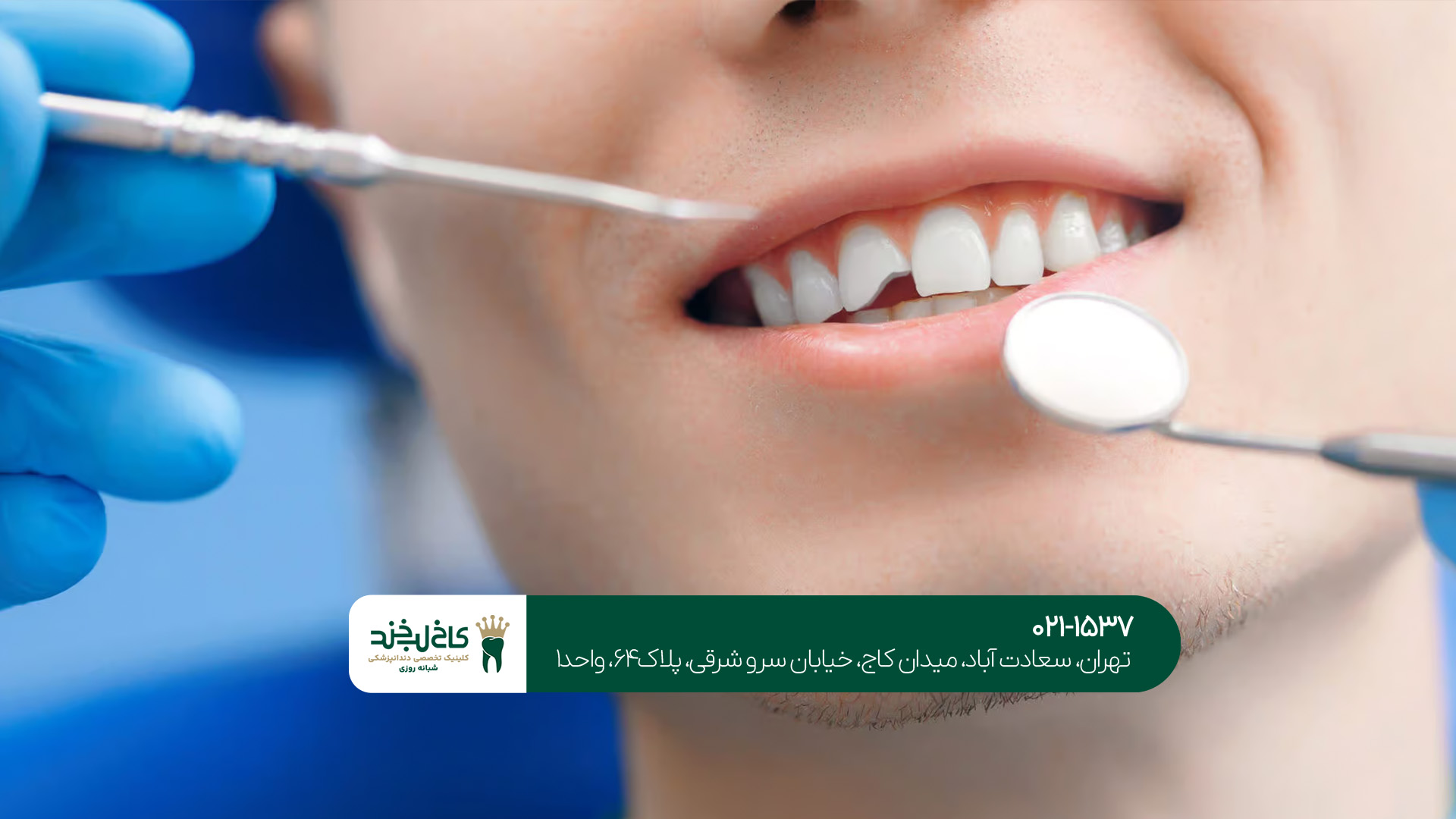 بهترین دندانپزشکی شبانه‌روزی تهران ویلا