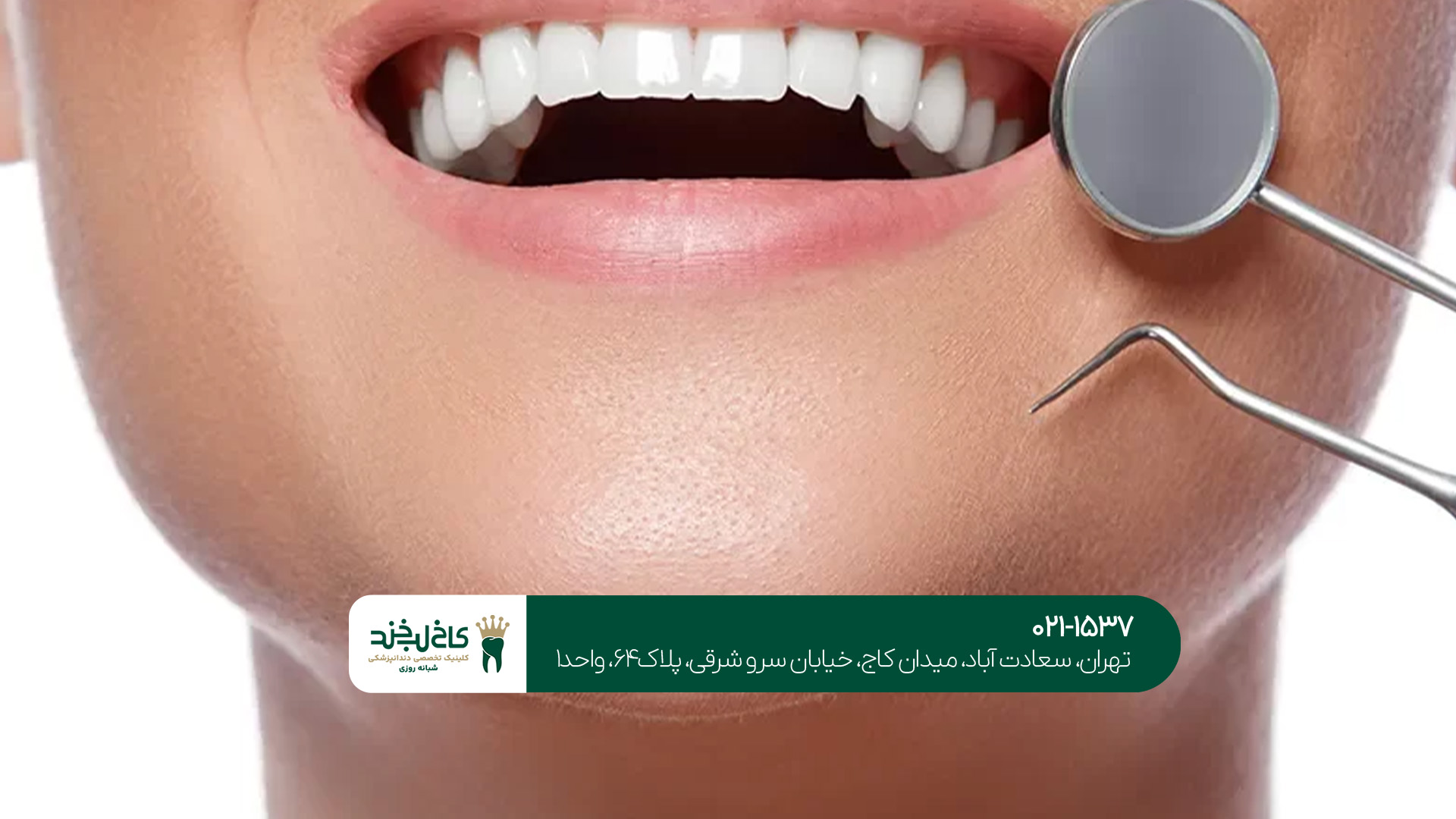 بهترین دندانپزشکی شبانه‌روزی تهران ویلا