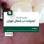 بهترین کلینیک ایمپلنت در شمال تهران