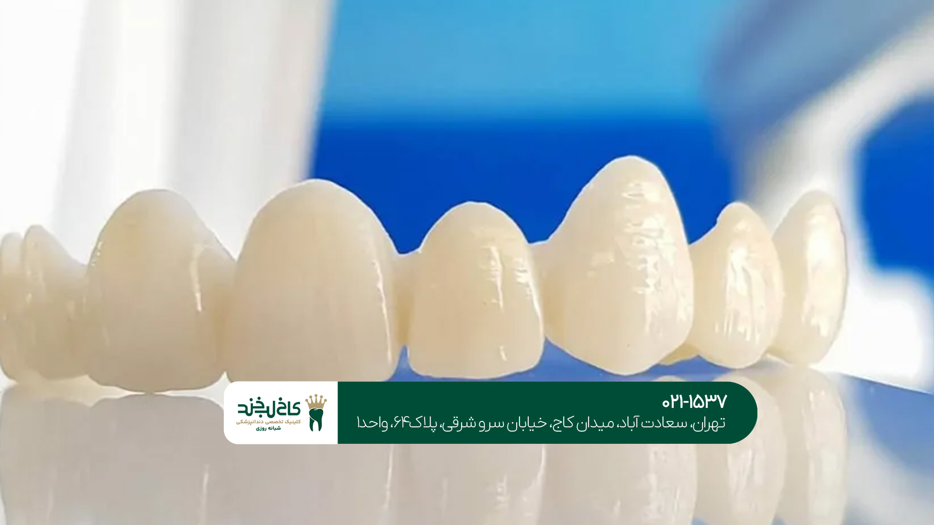 تفاوت روکش زیرکونیا و فلزی تفاوت روکش زیرکونیا و فلزی