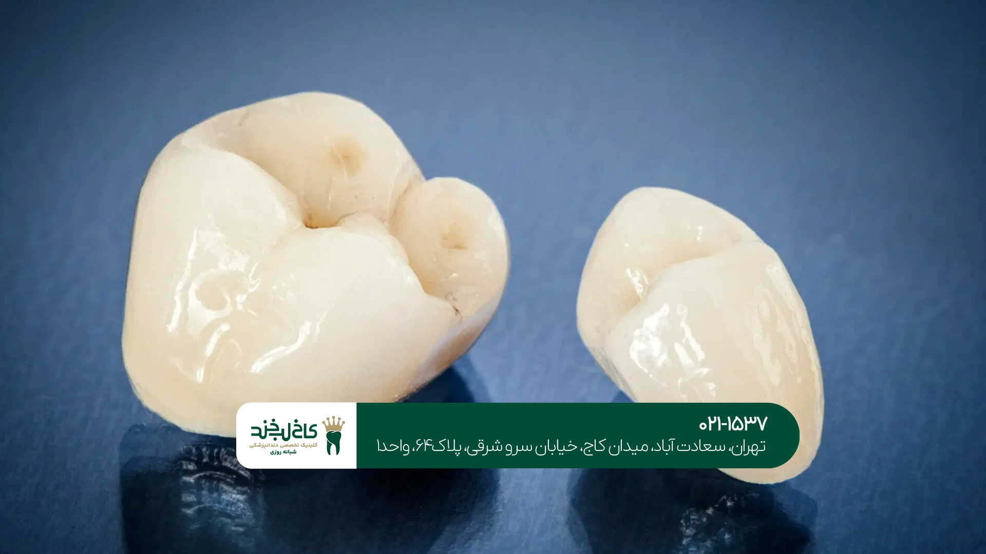 تفاوت روکش زیرکونیا و فلزی تفاوت روکش زیرکونیا و فلزی