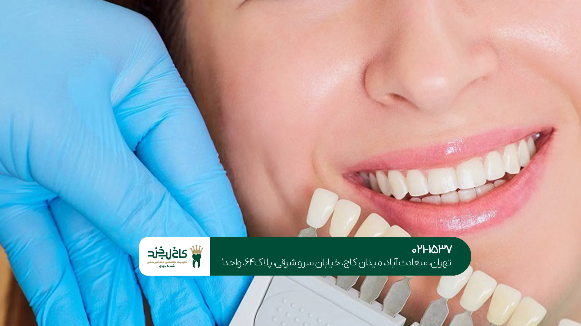 تفاوت لمینت و کامپوزیت چیست؟