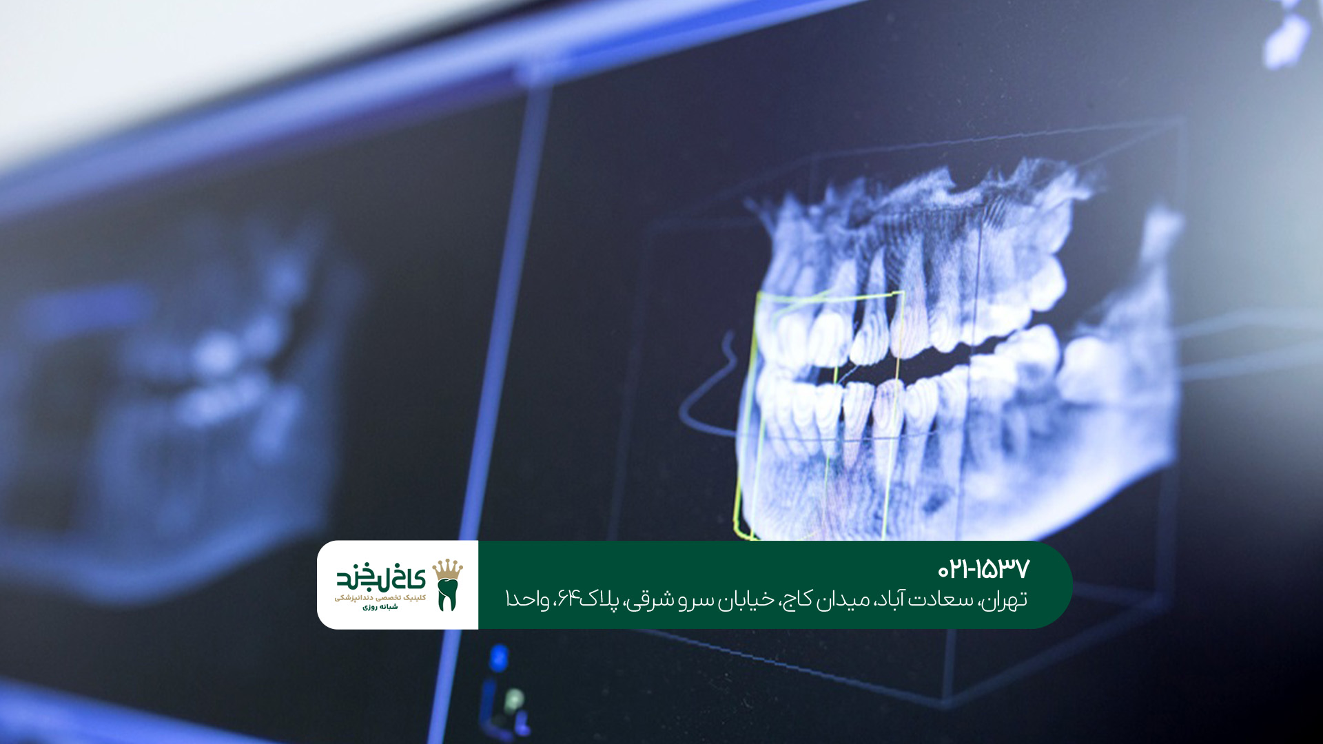 تکنولوژی دندانپزشکی دیجیتال تکنولوژی دندانپزشکی دیجیتال