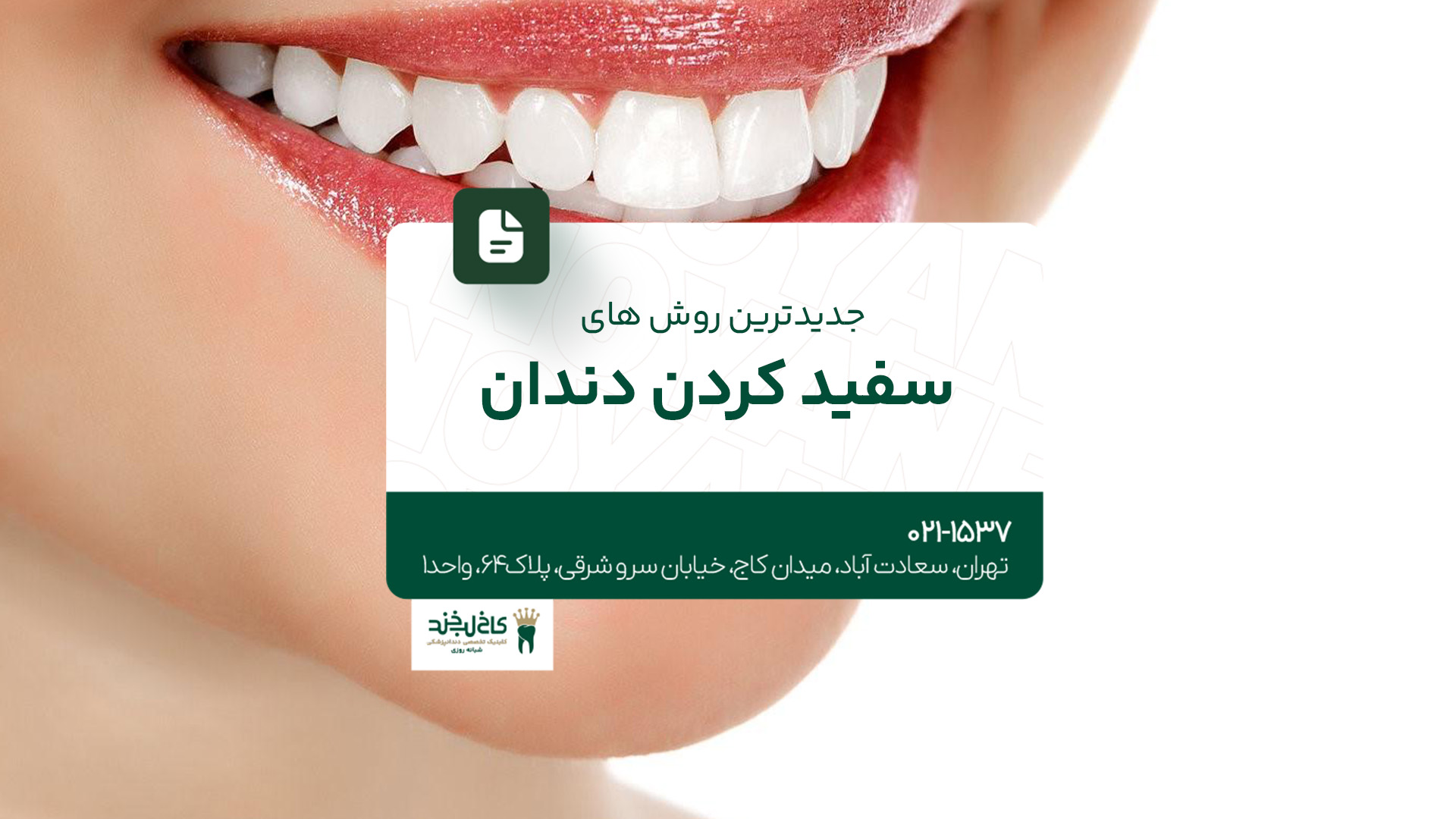 جدیدترین روش های سفید کردن دندان جدیدترین روش های سفید کردن دندان