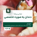 جراحی ریشه دندان به صورت تخصصی