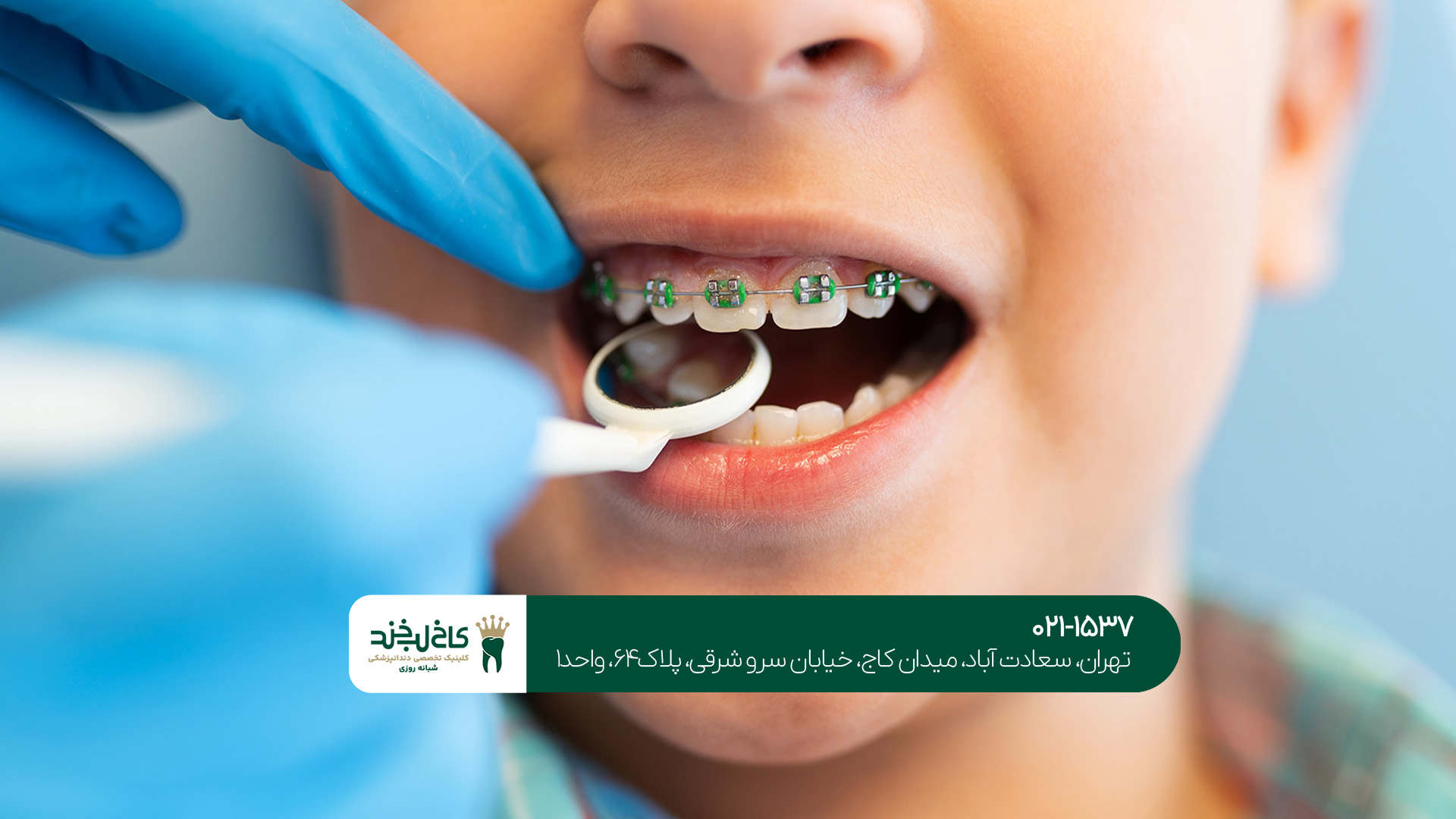 ارتودنسی بدون درد کودکان در تهران ارتودنسی بدون درد کودکان در تهران