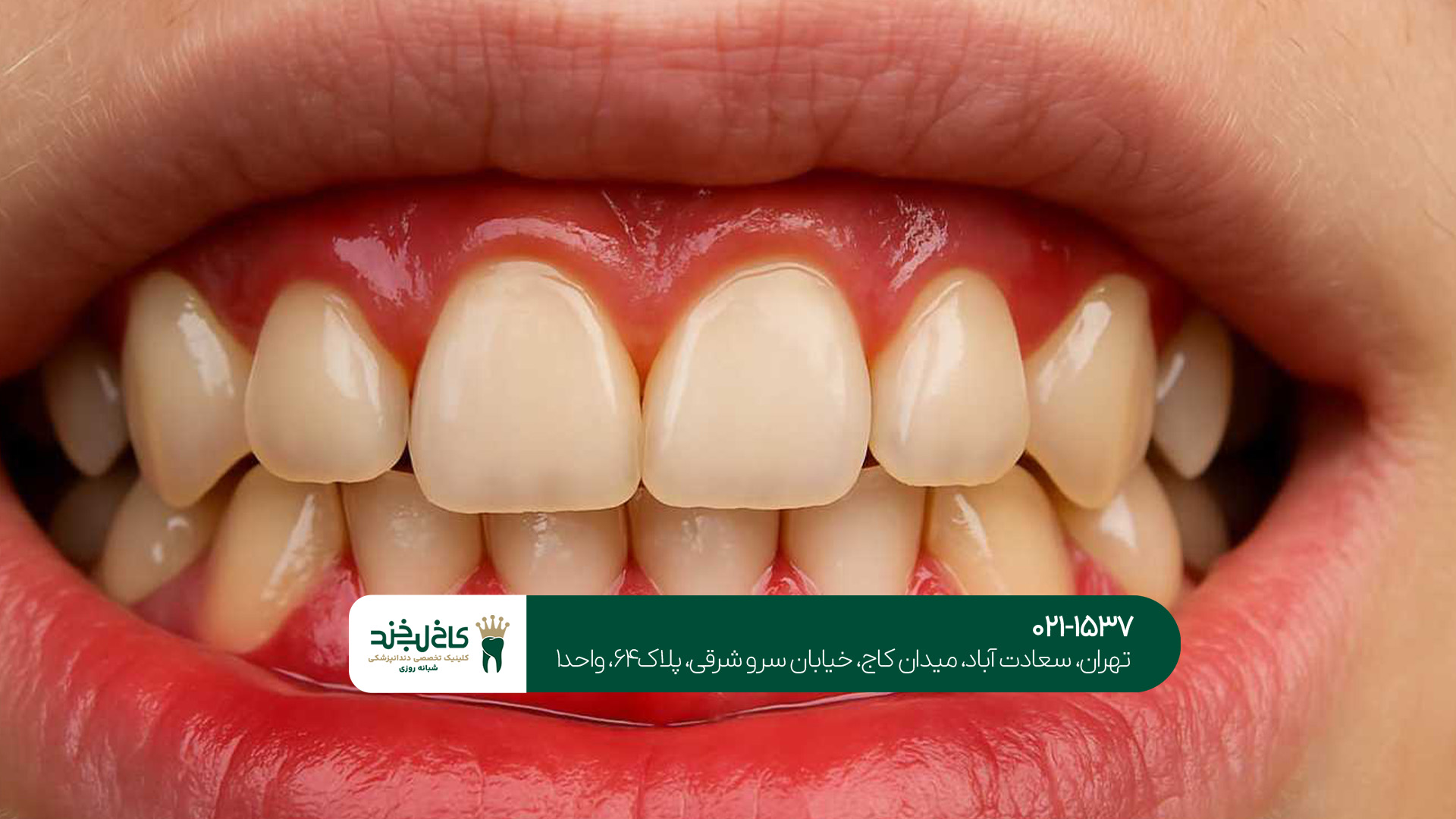 دندانپزشک متخصص اصلاح طرح لبخند