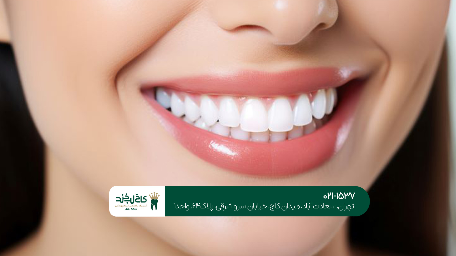 دندانپزشک متخصص زیبایی دندانپزشک متخصص زیبایی