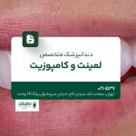 دندانپزشک متخصص لمینت و کامپوزیت
