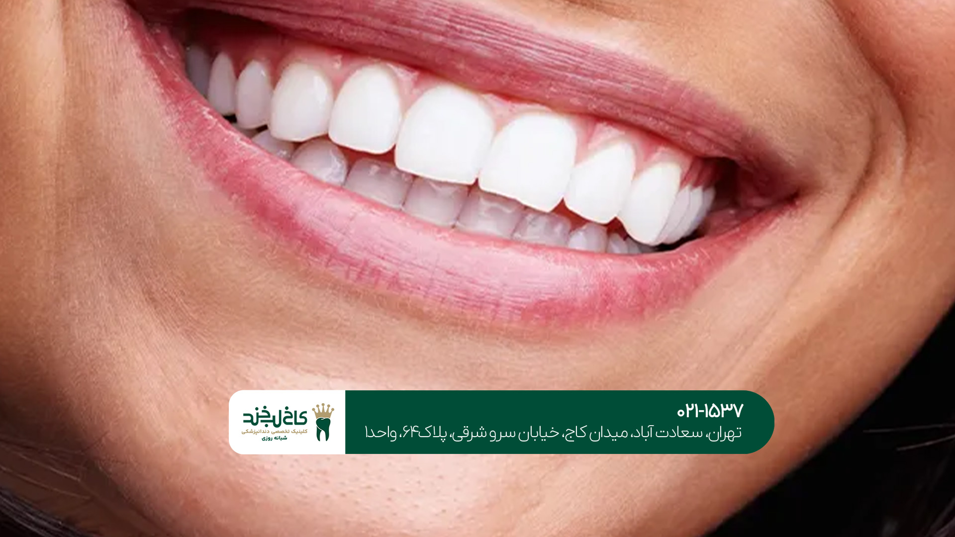 دندانپزشک متخصص اصلاح طرح لبخند