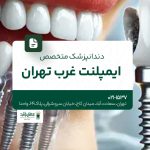 دندانپزشک متخصص ایمپلنت غرب تهران