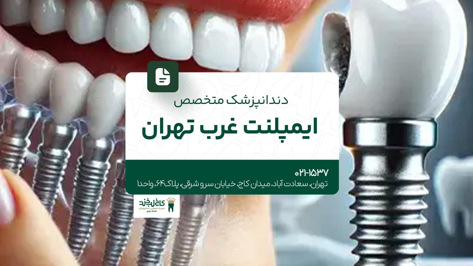 دندانپزشک متخصص ایمپلنت غرب تهران دندانپزشک متخصص ایمپلنت غرب تهران