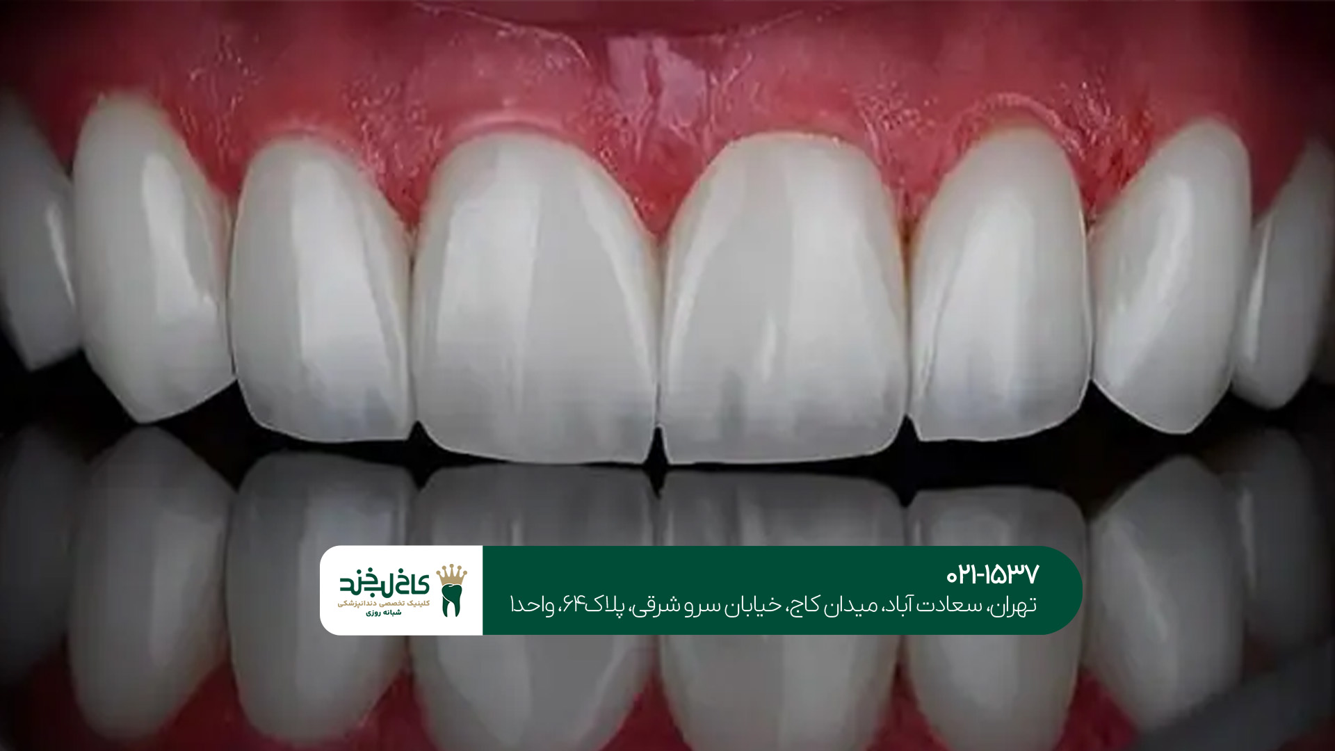 دندانپزشک متخصص لمینت و کامپوزیت