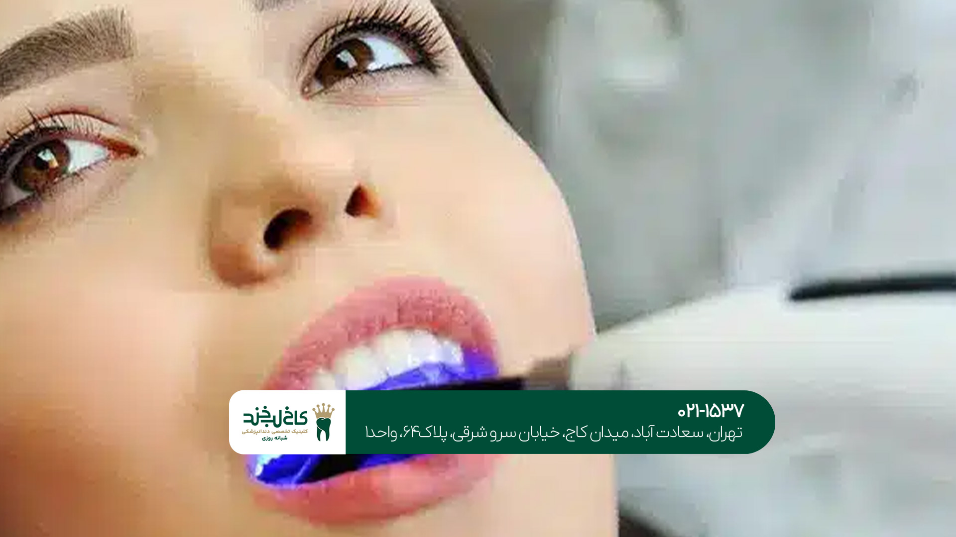 دندانپزشکی با لیز