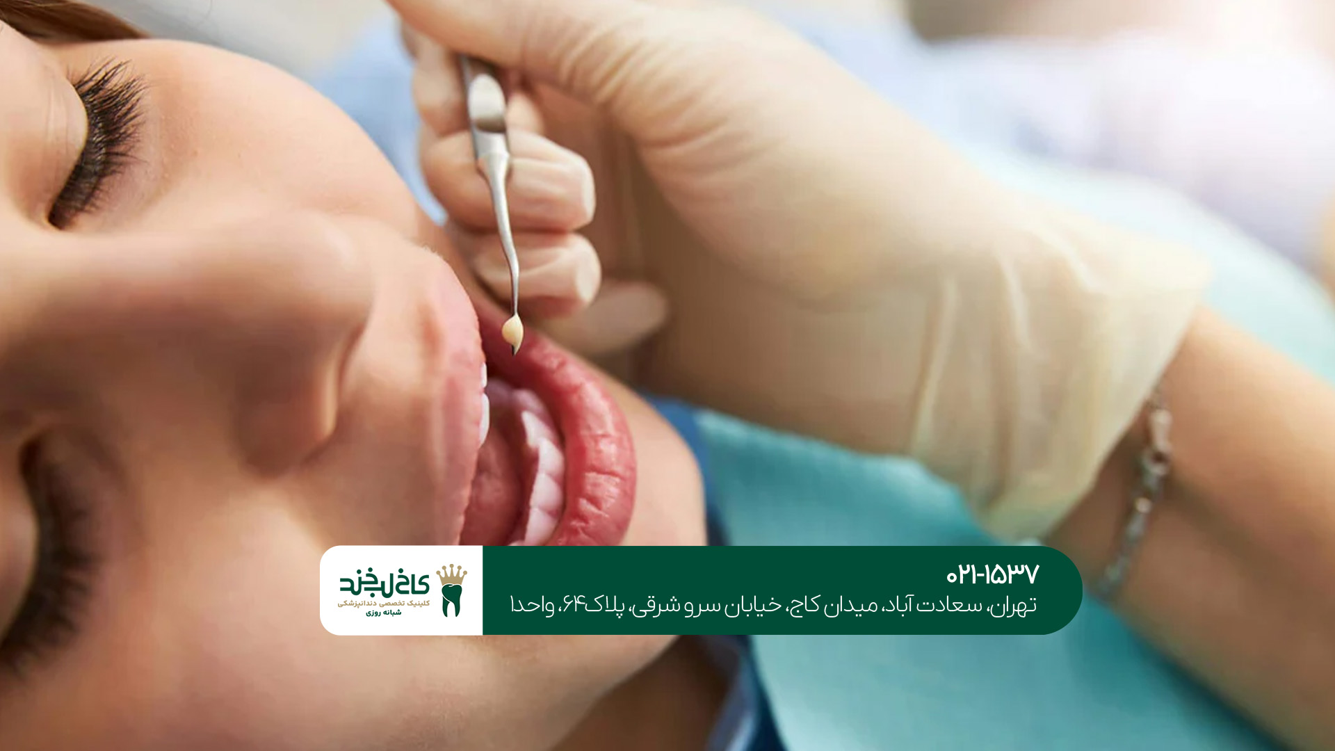 دندانپزشکی اقساطی