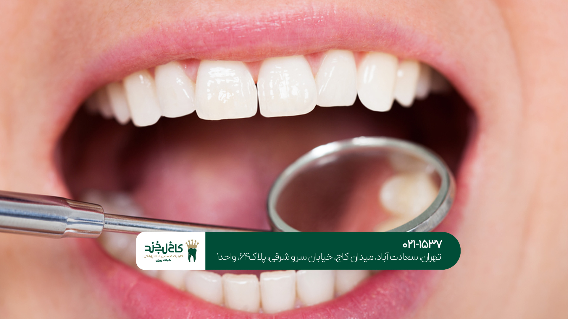 دندانپزشکی اقساطی