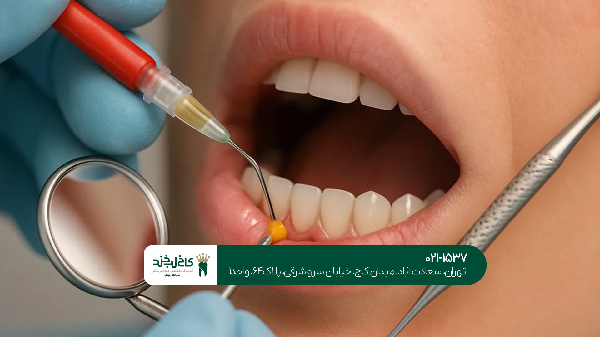 دندانپزشکی با تجهیزات پیشرفته در ایران دندانپزشکی با تجهیزات پیشرفته در ایران