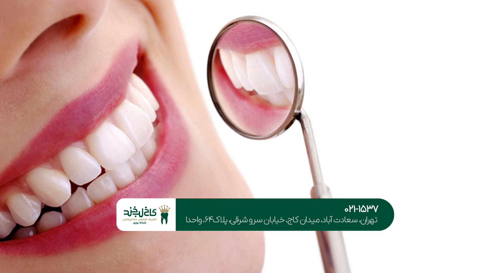 دندانپزشکی شبانه روزی در غرب تهران دندانپزشکی شبانه روزی در غرب تهران