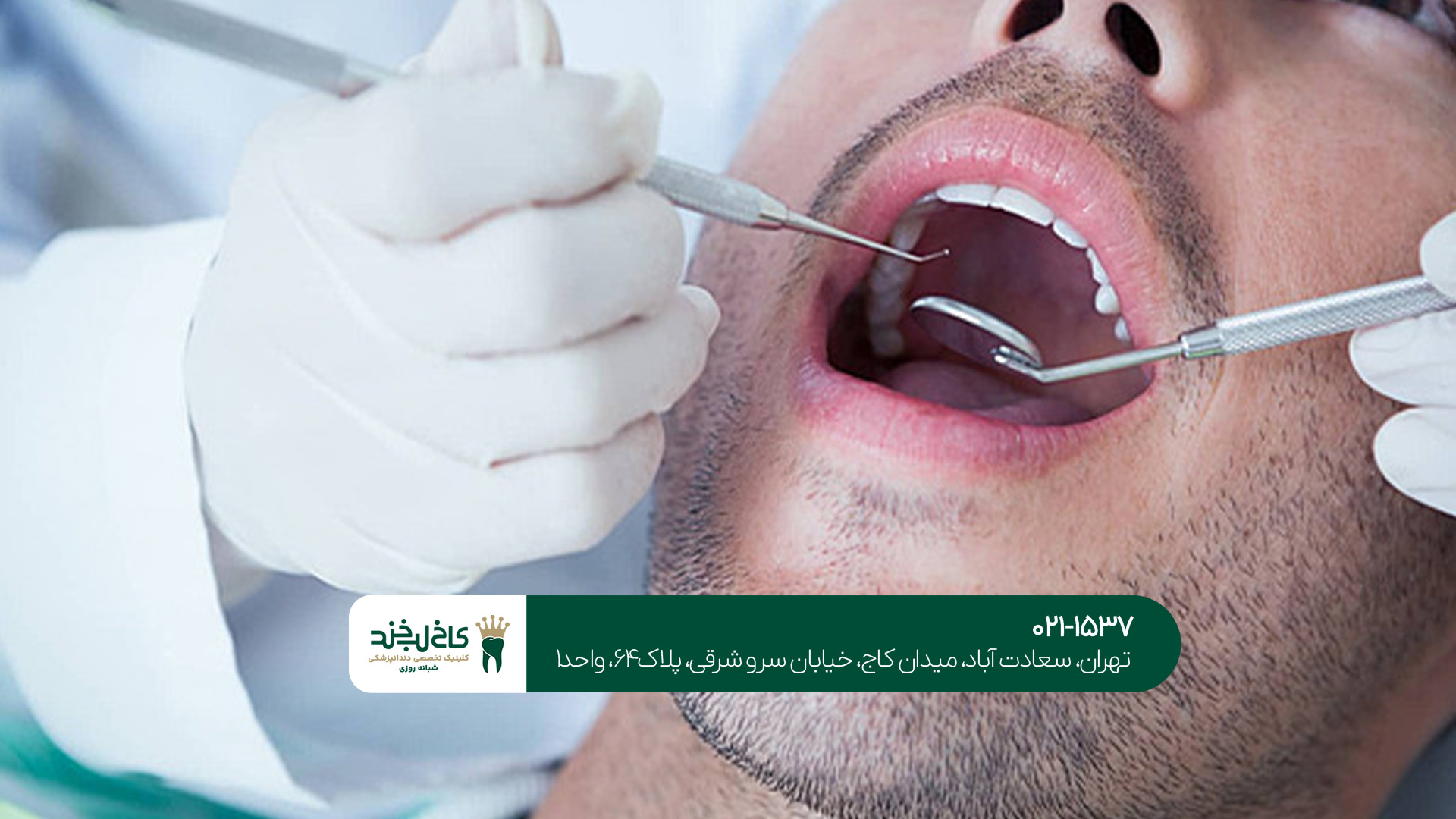 رزرو نوبت غیرحضوری دندانپزشکی رزرو نوبت غیرحضوری دندانپزشکی