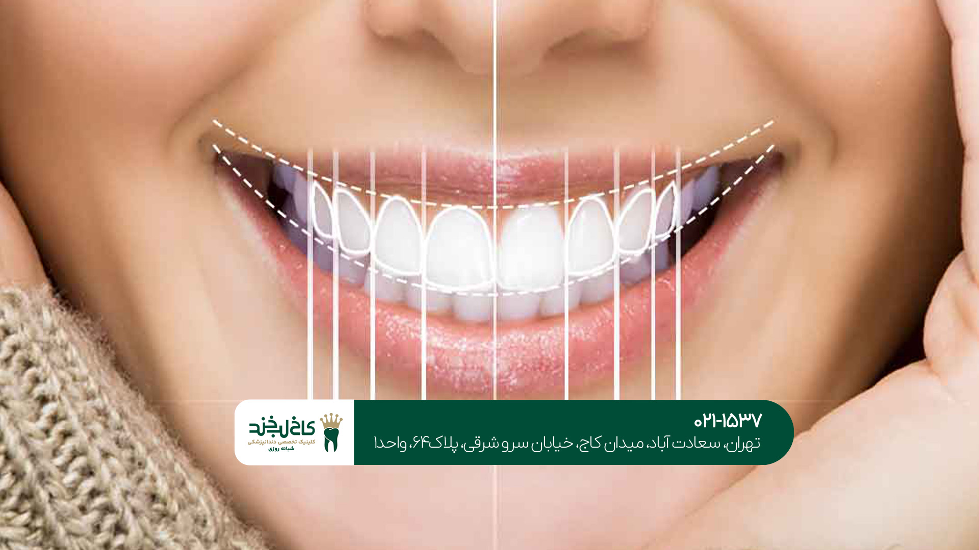 طراحی لبخند با هوش مصنوعی طراحی لبخند با هوش مصنوعی