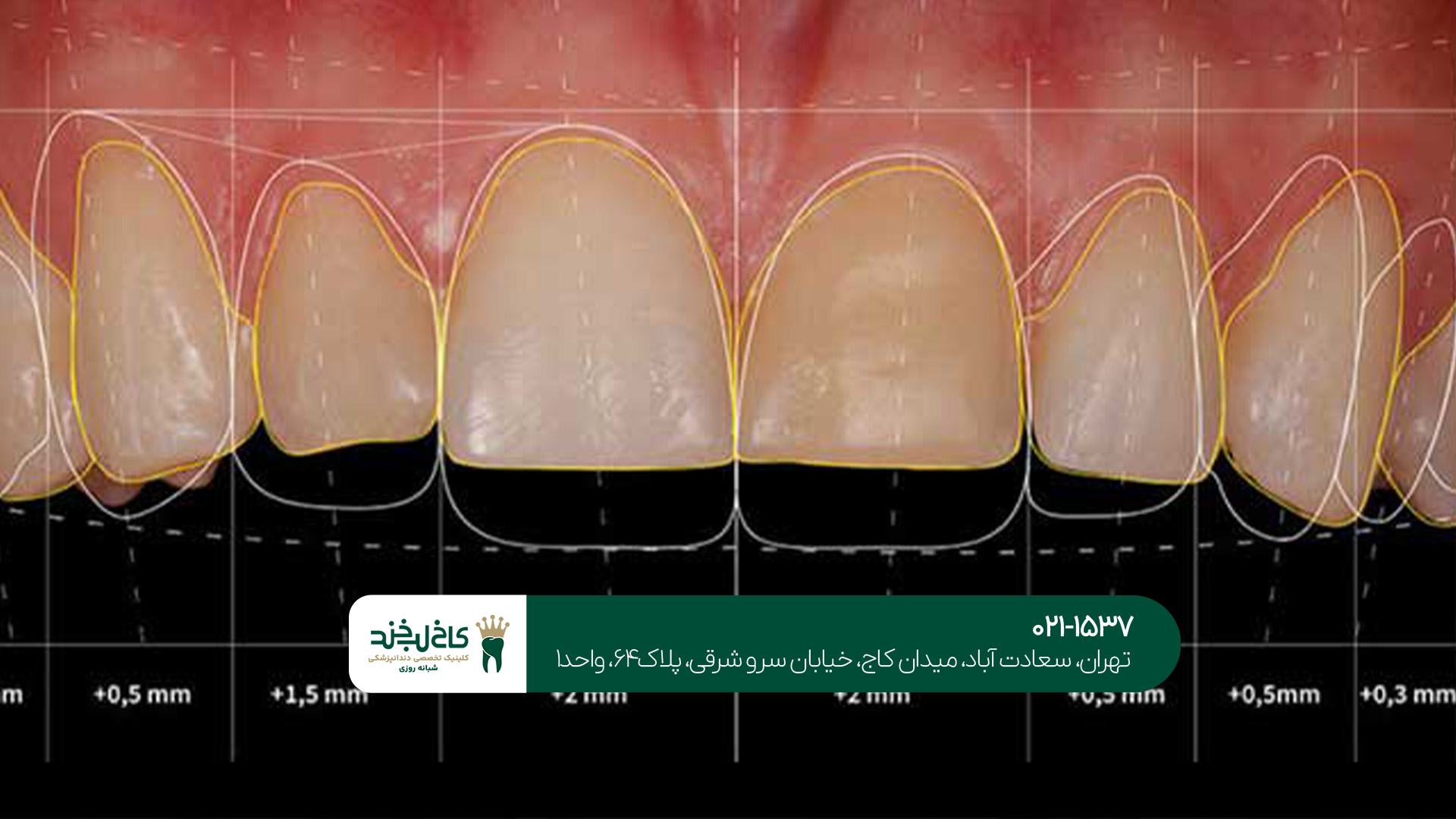 طراحی لبخند با هوش مصنوعی طراحی لبخند با هوش مصنوعی
