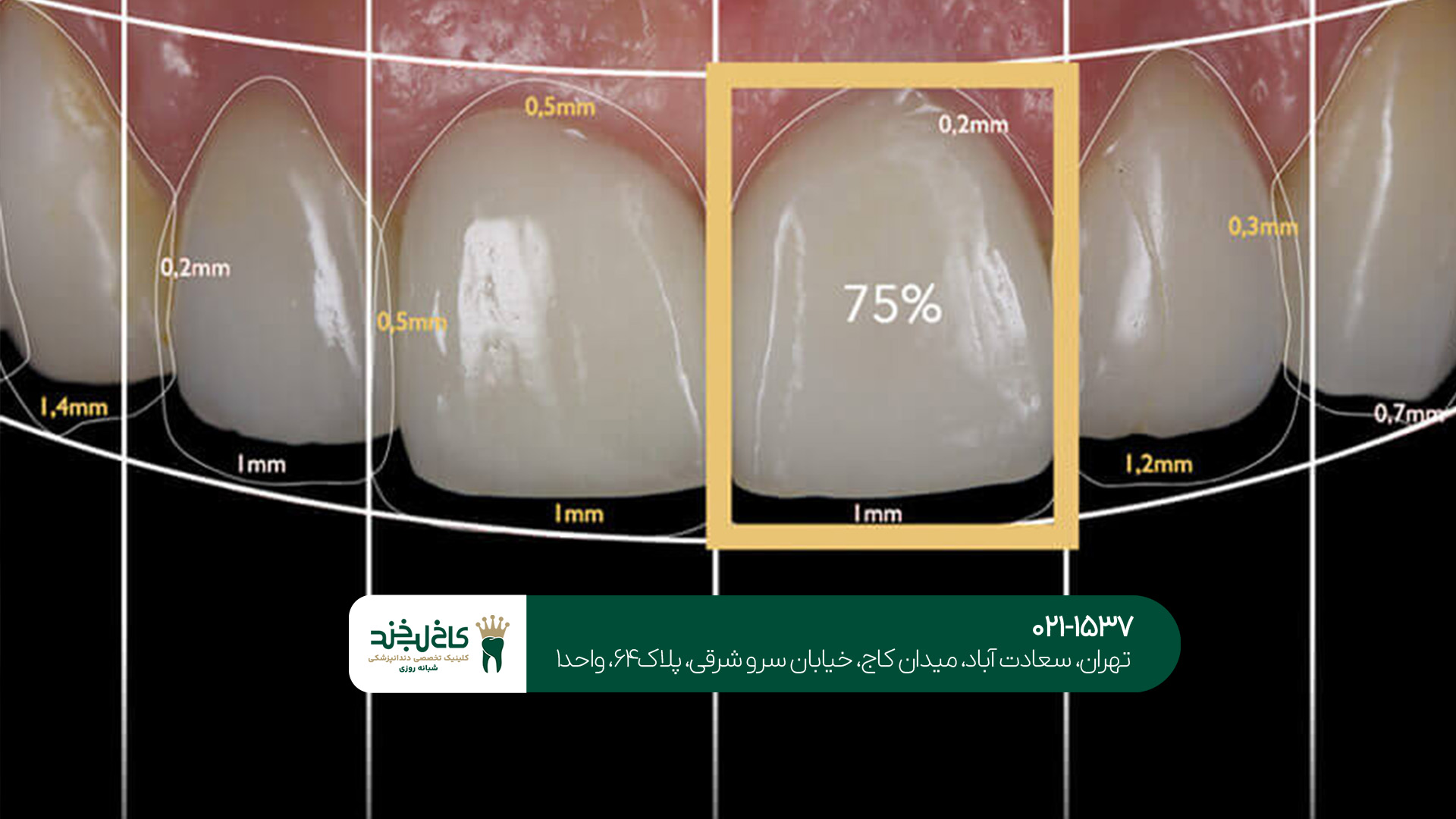 طراحی لبخند با هوش مصنوعی طراحی لبخند با هوش مصنوعی
