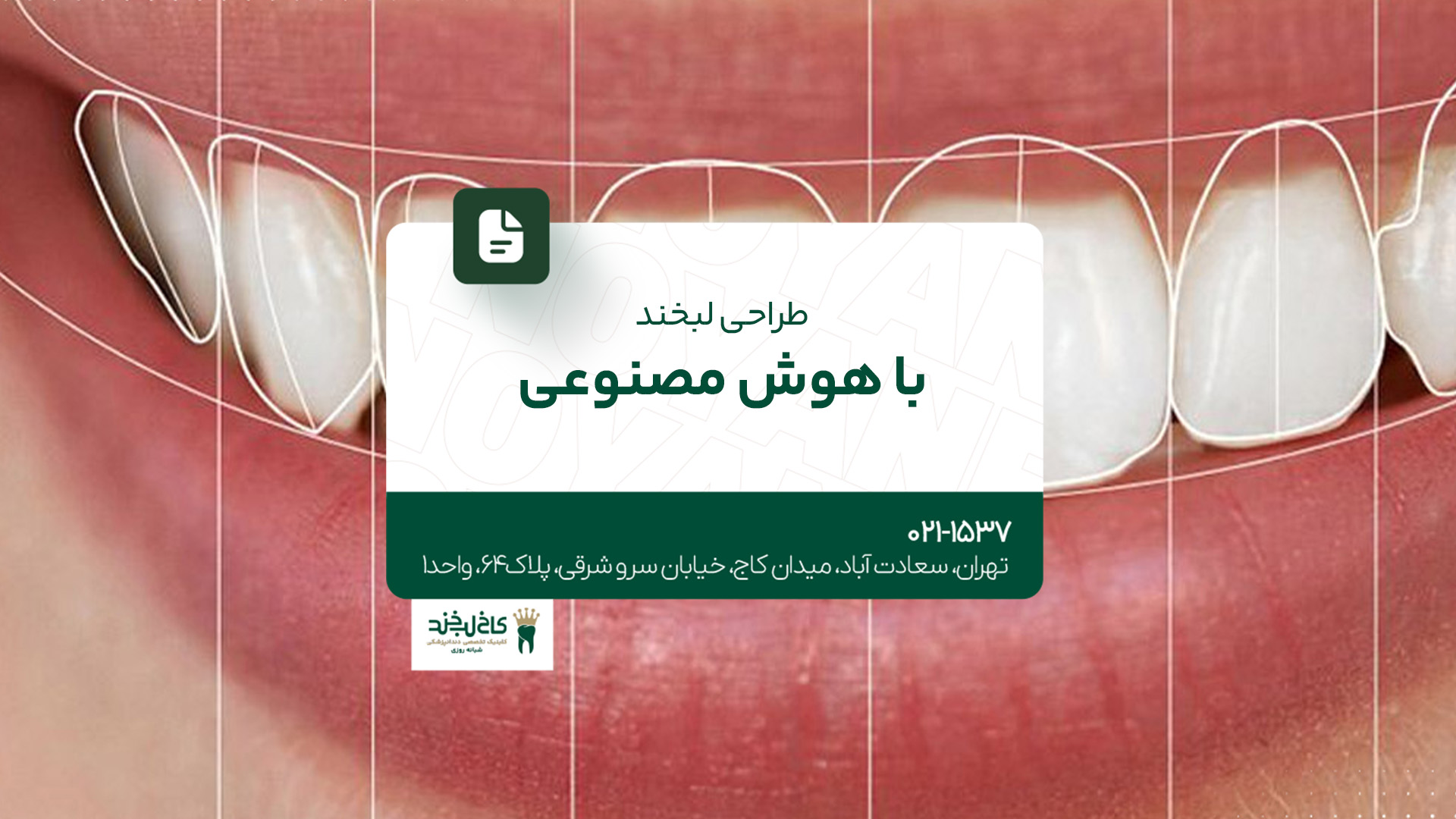 طراحی لبخند با هوش مصنوعی طراحی لبخند با هوش مصنوعی