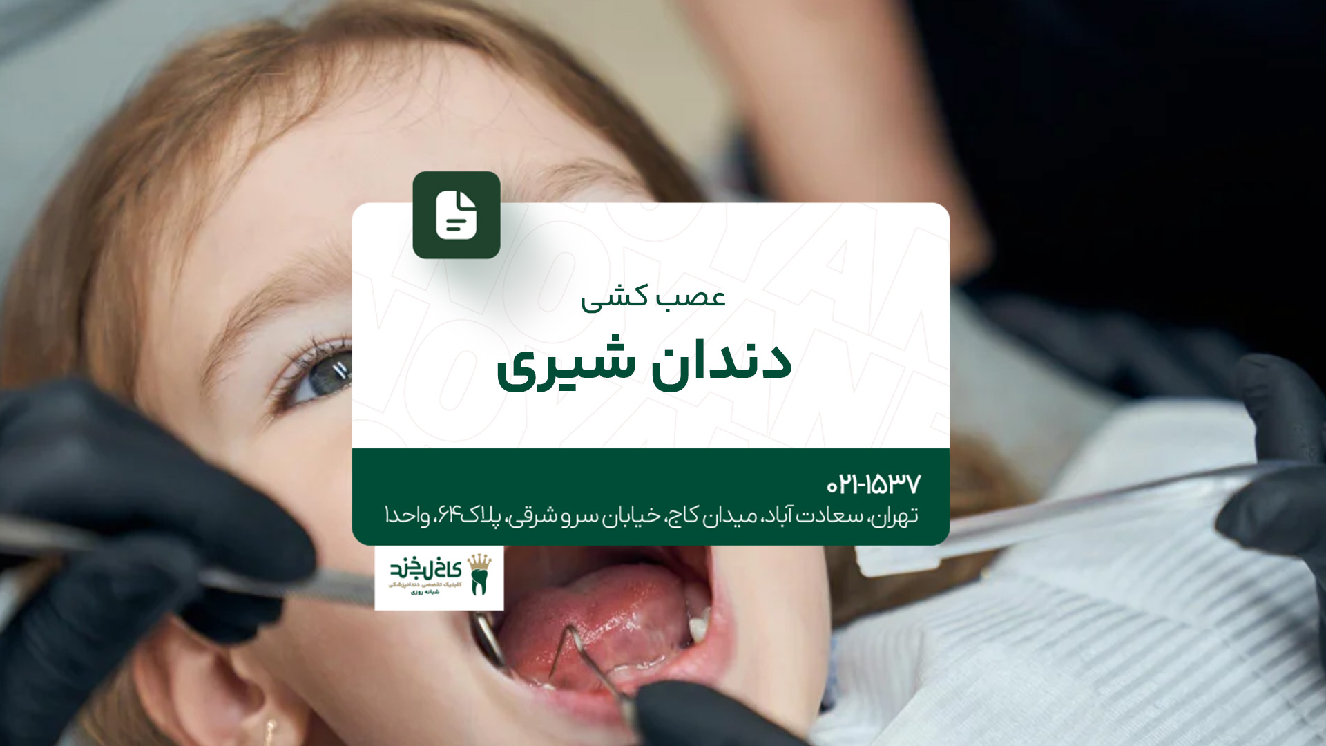 عصب کشی دندان شیری عصب کشی دندان شیری