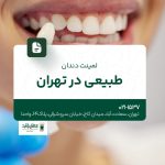 لمینت دندان طبیعی در تهران