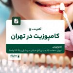 لمینت و کامپوزیت در تهران