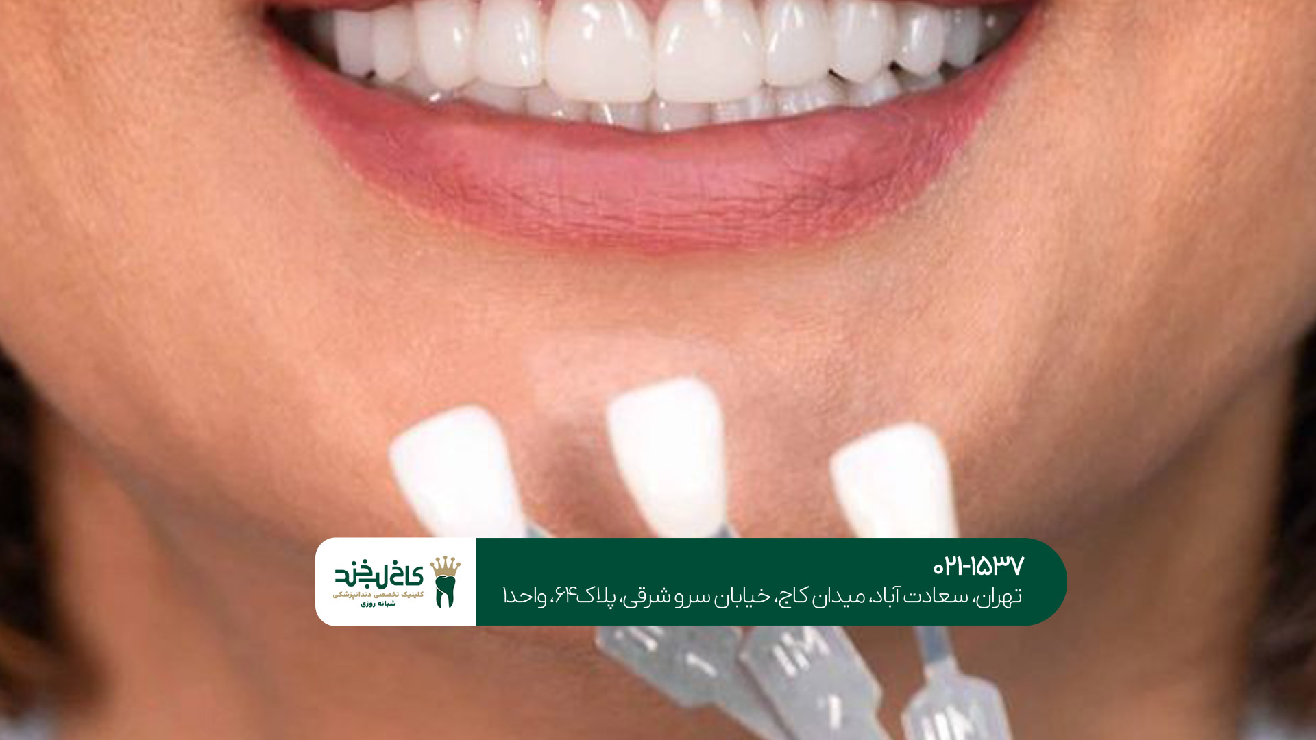 لمینت و کامپوزیت در تهران لمینت و کامپوزیت در تهران