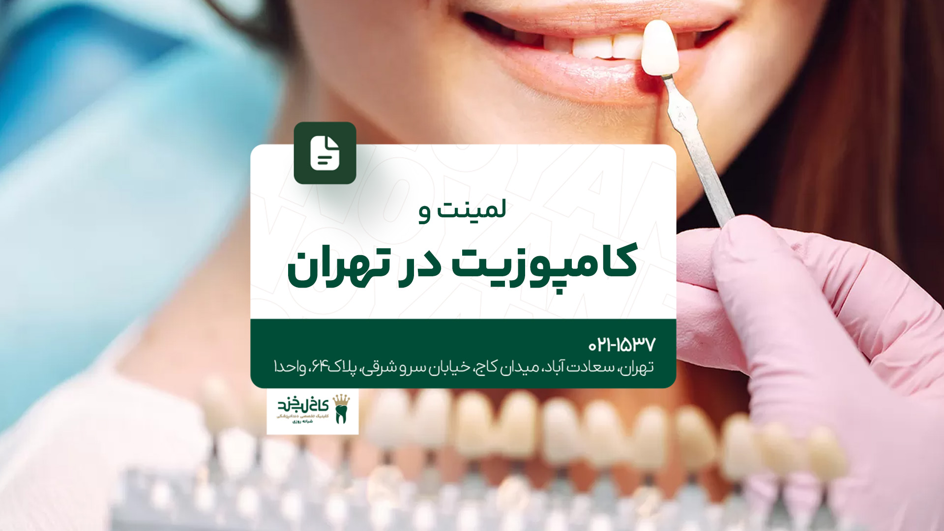 لمینت و کامپوزیت در تهران لمینت و کامپوزیت در تهران